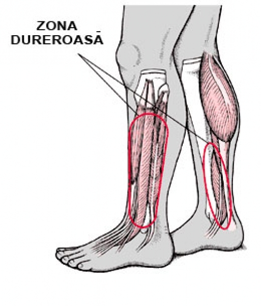 durere la nivelul mușchilor și articulațiilor gambei dureri articulare progesteron